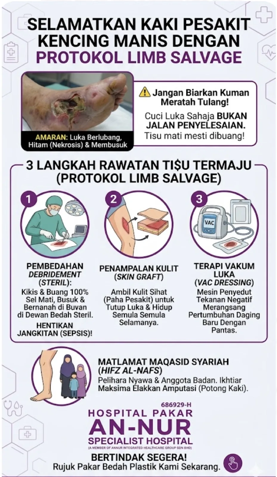 Infografik Protokol Limb Salvage Hospital Pakar An-Nur — 3 langkah rawatan tisu termaju (Pembedahan Debridement, Penampalan Kulit Skin Graft, Terapi Vakum VAC) untuk menyelamatkan kaki pesakit ulser diabetik dan mengelakkan amputasi